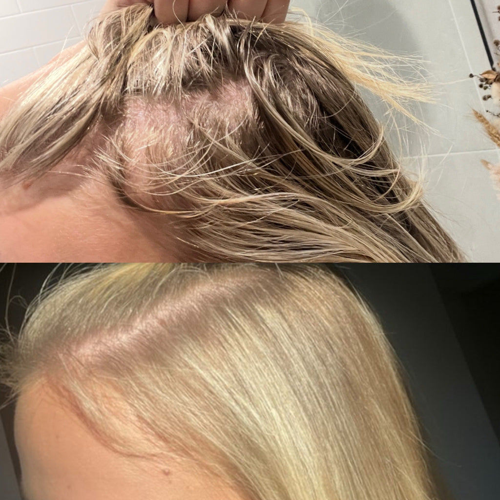 The Growth - Scalp oil