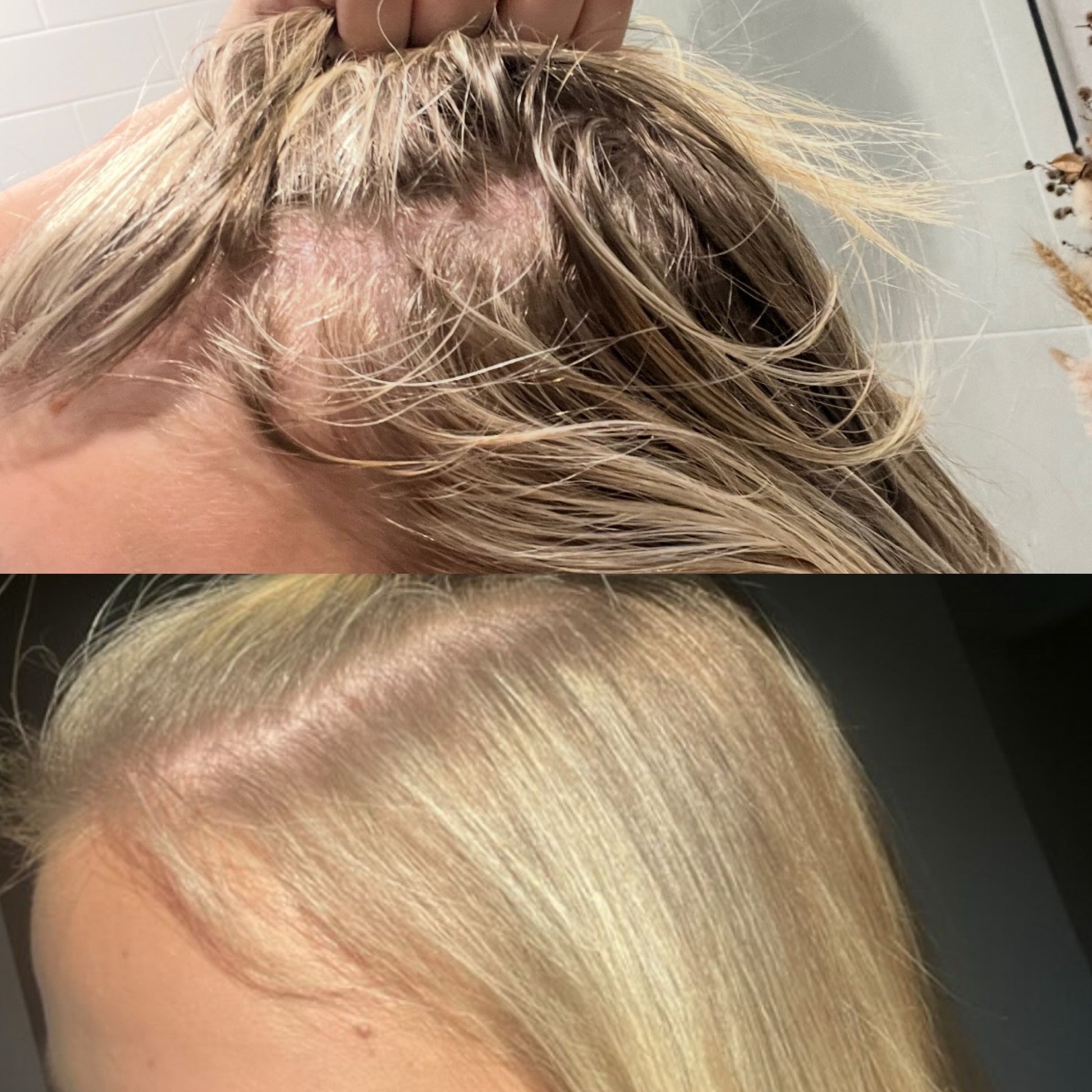 The Growth - Scalp oil